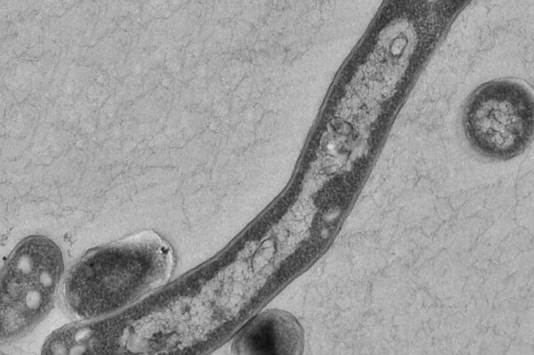 Tuberkulose - Grazer Forschende entdeckten neue Angriffsstelle