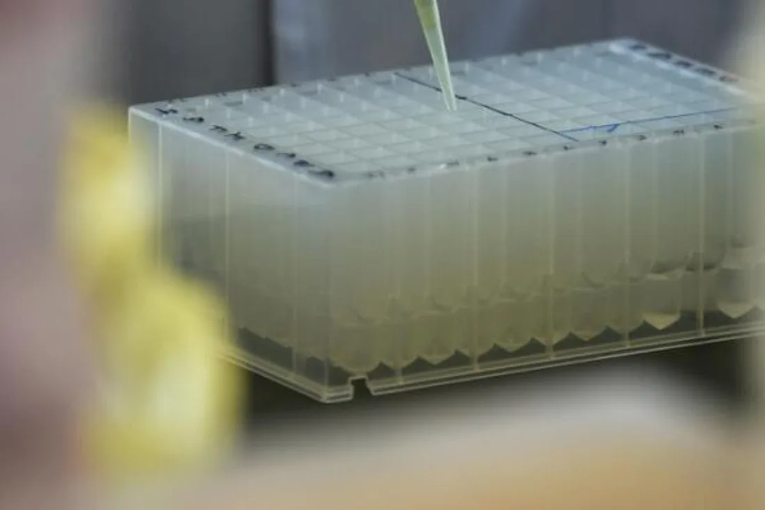 DNA-Sequenzierung soll Diagnose komplexer Infektionen verbessern