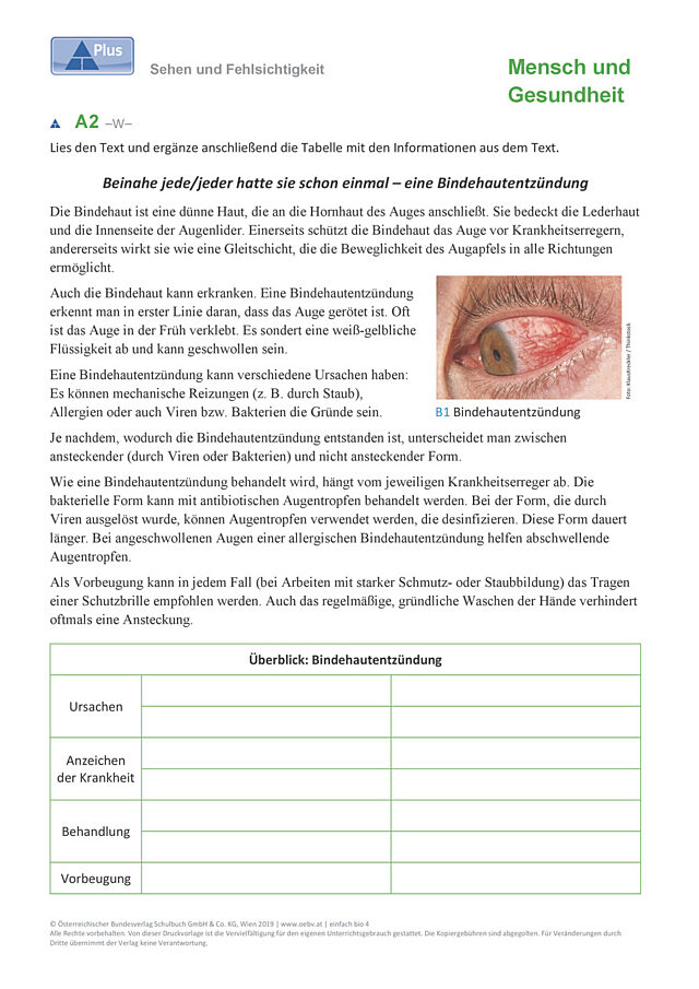 Sehen Fehlsichtigkeit