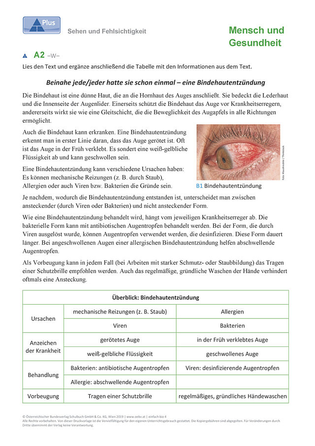 Sehen Fehlsichtigkeit